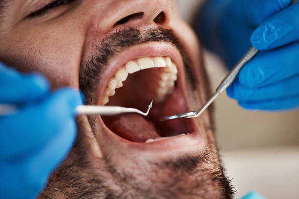 Best Same-Day Emergency Dentist in Tye, TX