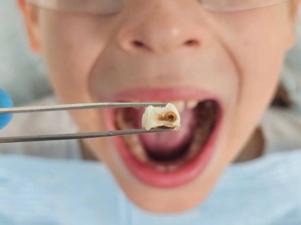 Best Pediatric Emergency Dentist in Tye, TX